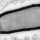 Illustration for article titled What a 30,000-Year-Old Giant Zombie Virus Means For the Future